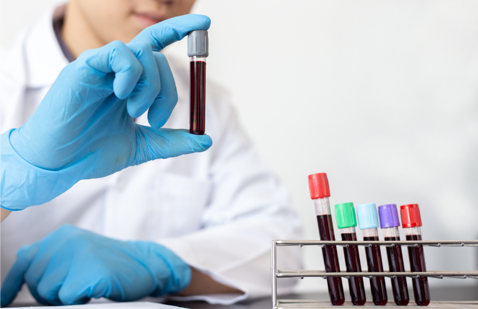 Krevní testy dokáží THC odhalit až po 7 dní